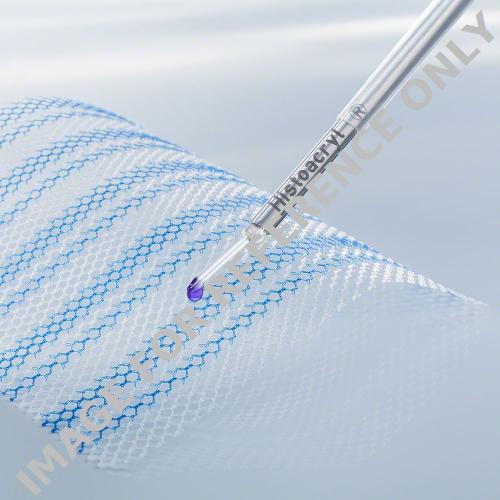 Histoacryl® LapFix, zur laparoskopischen Netzfixierung, 5 Applikatoren und 5x Histoacryl Kleber à 0,5 ml-null