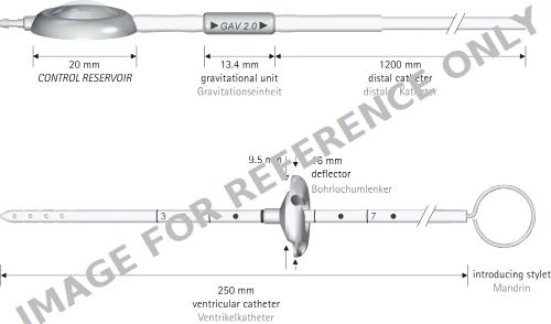 GAV® 2.0 SHUNT SYSTEM WITH CONTROL RESERVOIR-null