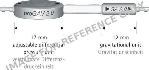 proGAV ® 2.0-null