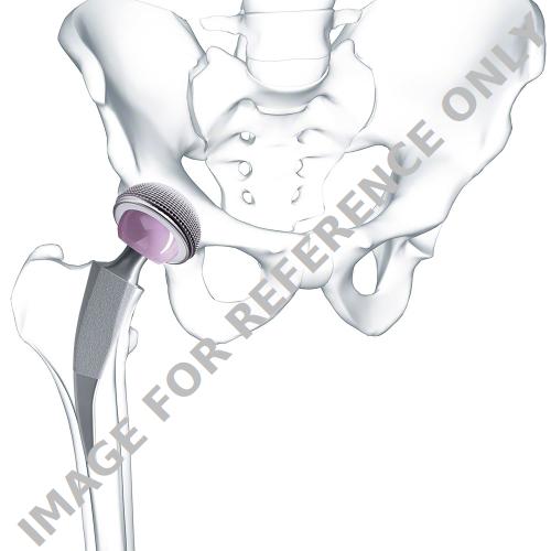 <p>Metha®</p>-<p>Short stem – Evolving the State of Arthroplasty</p>