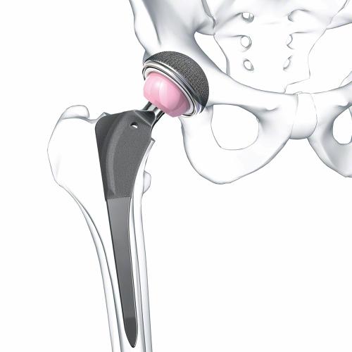 product.alt Bicontact® Hip Stem System