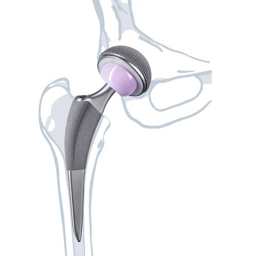 product.alt Excia® T Hip Stem System